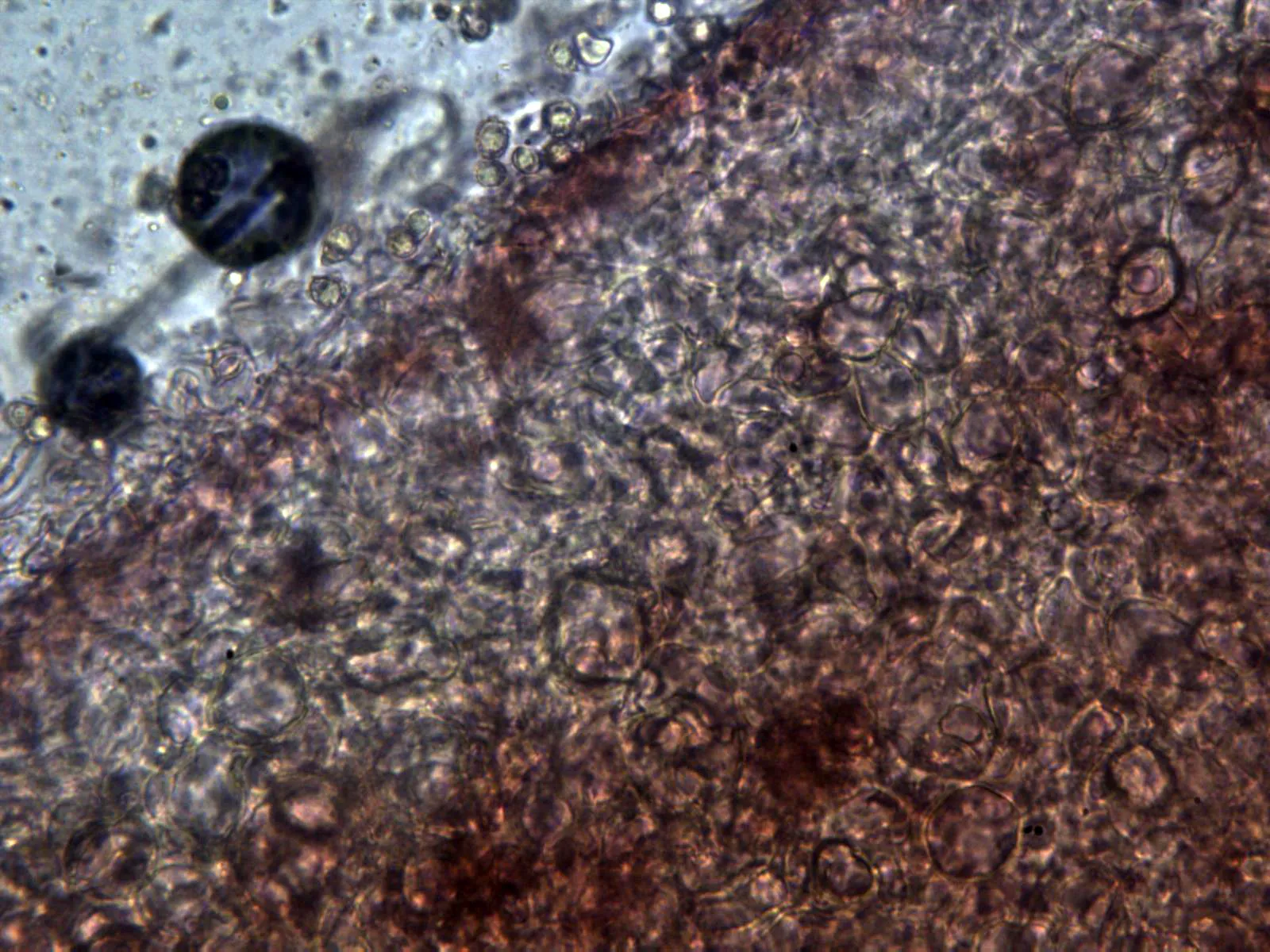 Microscopía de Russula roseipes - 10 -  Pileipellis x 400